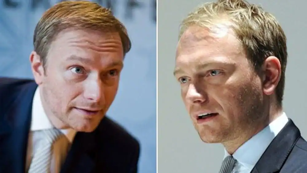 Christian Lindner Haartransplantation vorher nachher