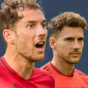 leon goretzka haartransplantation