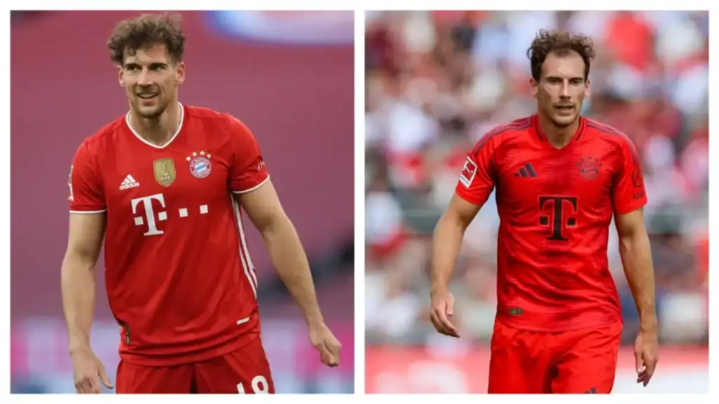 Leon Goretzka Haartransplantation Vorher-Nachher