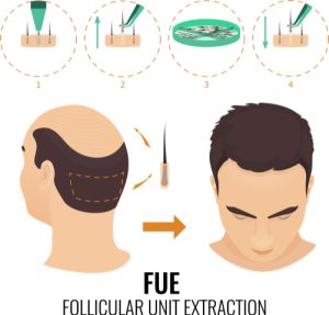 FUT-diagram-1